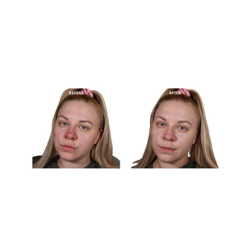 Revolution - Cream Color Primer Superbase Colour Correcting - Green