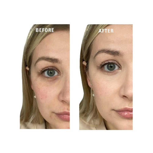 Revolution - Cream Color Primer Superbase Colour Correcting - Yellow