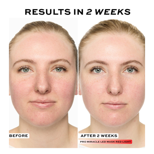 Revolution Pro - Face Mask Miracle LED Face Mask