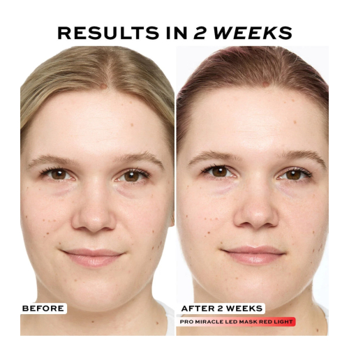 Revolution Pro - Face Mask Miracle LED Face Mask