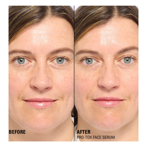 Revolution Pro - *Miracle Pro-Tox* - Repairing and line-filling facial serum