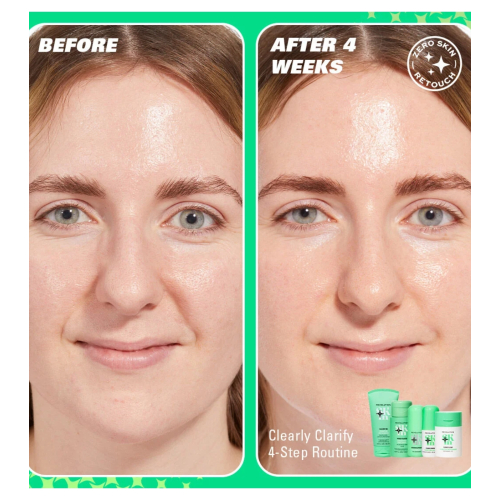 Revolution Skin - *Clearly Clarify* - Clarifying facial serum 5% niacinamide and 2% salicylic acid Clear Canvas