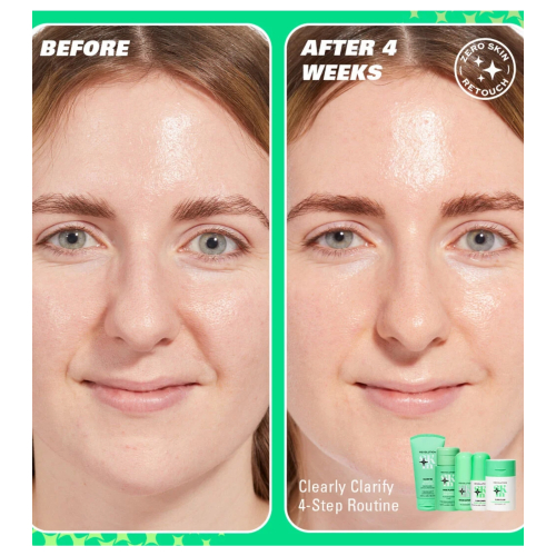 Revolution Skin - *Clearly Clarify* - Clarifying facial serum 10% niacinamide Serum Supreme