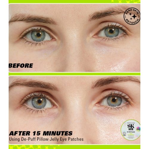 Revolution Skin - Hydrogel Eye Patches with Hyaluronic Acid Jelly De-Puff Pillow