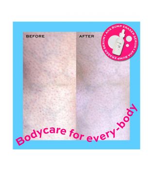 Revolution Skincare - *Body Skincare* - Body Serum AHA Bump Eraser