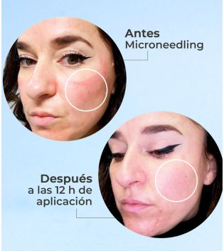 SEGLE - Regenerating anti-aging facial serum Skin Factor - Sensitive skin