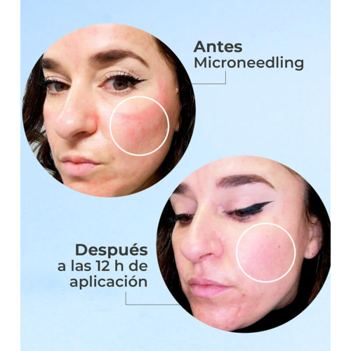 SEGLE - Regenerating anti-aging facial serum Skin Factor - Sensitive skin