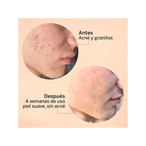 SEGLE - AHA/BHA exfoliating facial serum