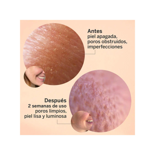 SEGLE - Glycolmix Glycolic Acid Exfoliating Facial Serum