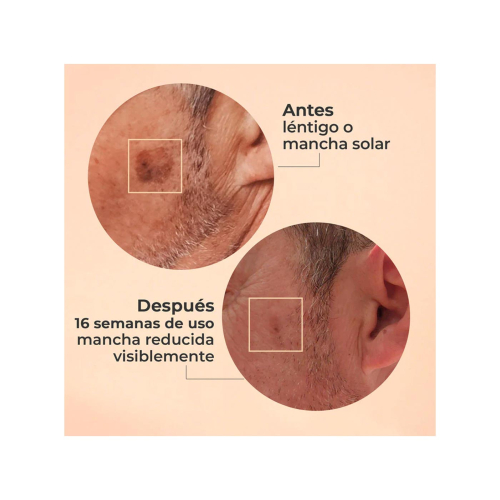 SEGLE - Glycolmix Glycolic Acid Exfoliating Facial Serum