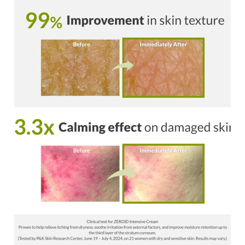 Zeroid - Intensive Repair Cream
